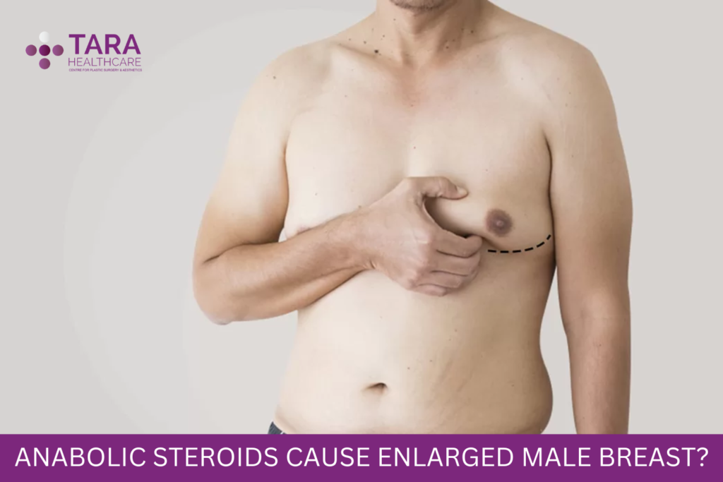 Does The Use of Anabolic Steroids Cause Enlarged Make Breast