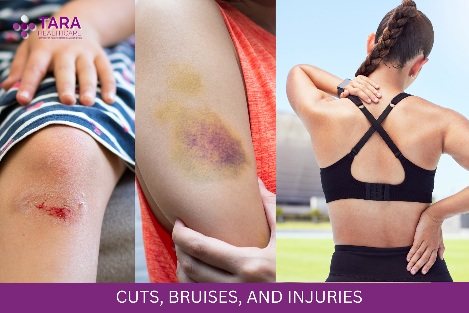 Treatment for Cuts, Bruises & Injuries? - Tara Healthcare