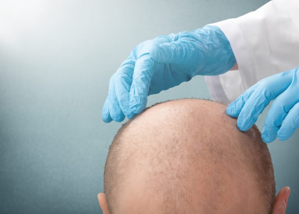 concept hair transplantation with modern technique 1